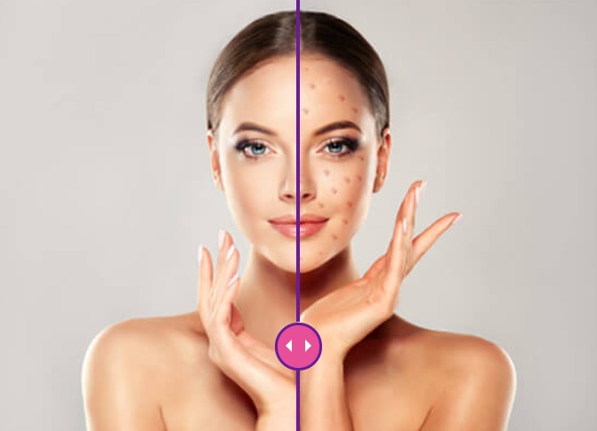 plastic surgery in Thrissur